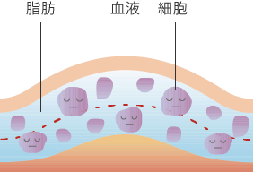 ヴィヴィアーニ ワンサイズダウン 使用前